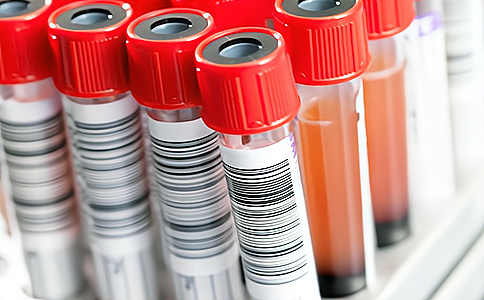 RFID系統(tǒng)在血液采集、存儲(chǔ)與運(yùn)輸中的應(yīng)用設(shè)計(jì)